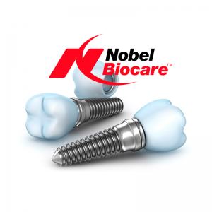 Имплантация Nobel Biocare под ключ – 54 900 р.